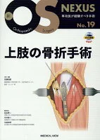 上肢の骨折手術